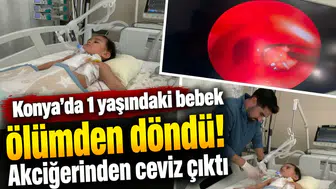 Konya’da 1 yaşındaki bebek ölümden döndü! Akciğerinden ceviz çıktı