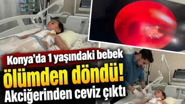 Konya’da 1 yaşındaki bebek ölümden döndü! Akciğerinden ceviz çıktı
