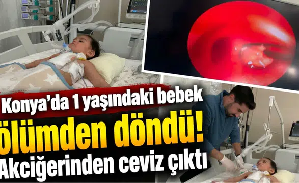 Konya’da 1 yaşındaki bebek ölümden döndü! Akciğerinden ceviz çıktı